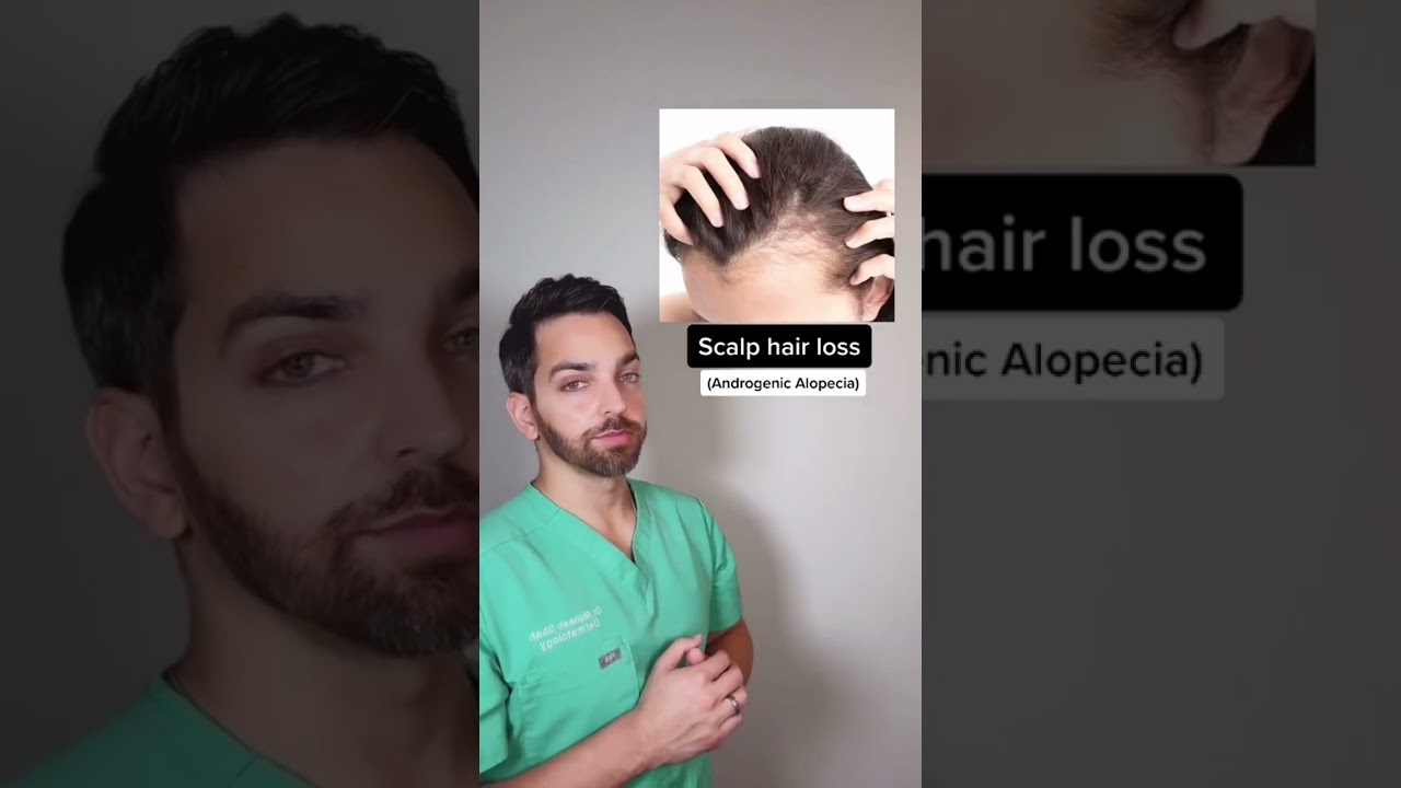 Skin Signs of PCOS! Discuss with your doctor #shorts