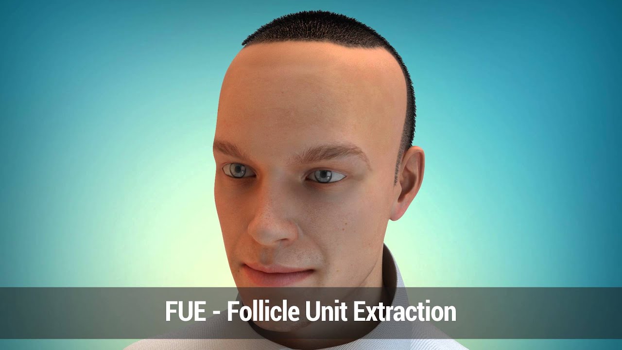 Hair Repair Clinic FUE v FUT