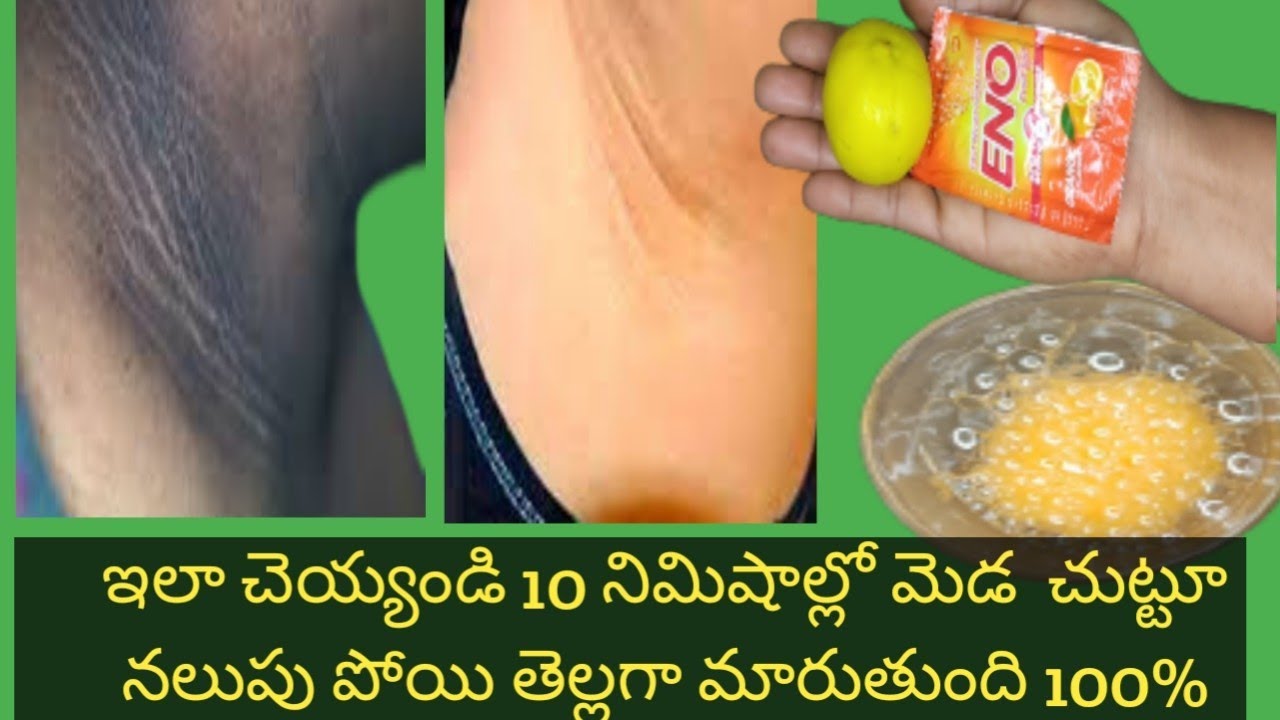 5minitues how to get rid of dark neck fast eay tip/dark neck solution / in telugu