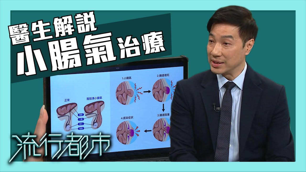 流行都市｜醫生解說小腸氣治療｜外科｜手術
