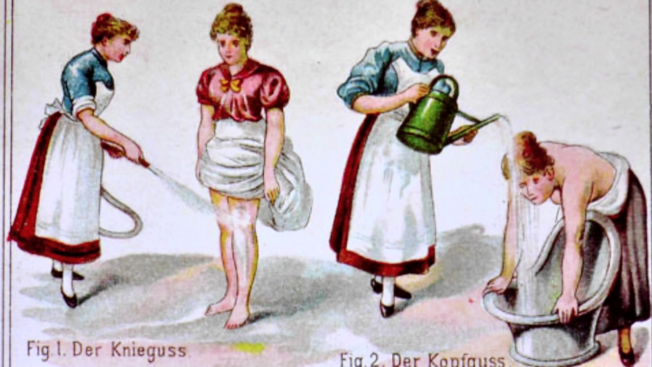 Knieguss