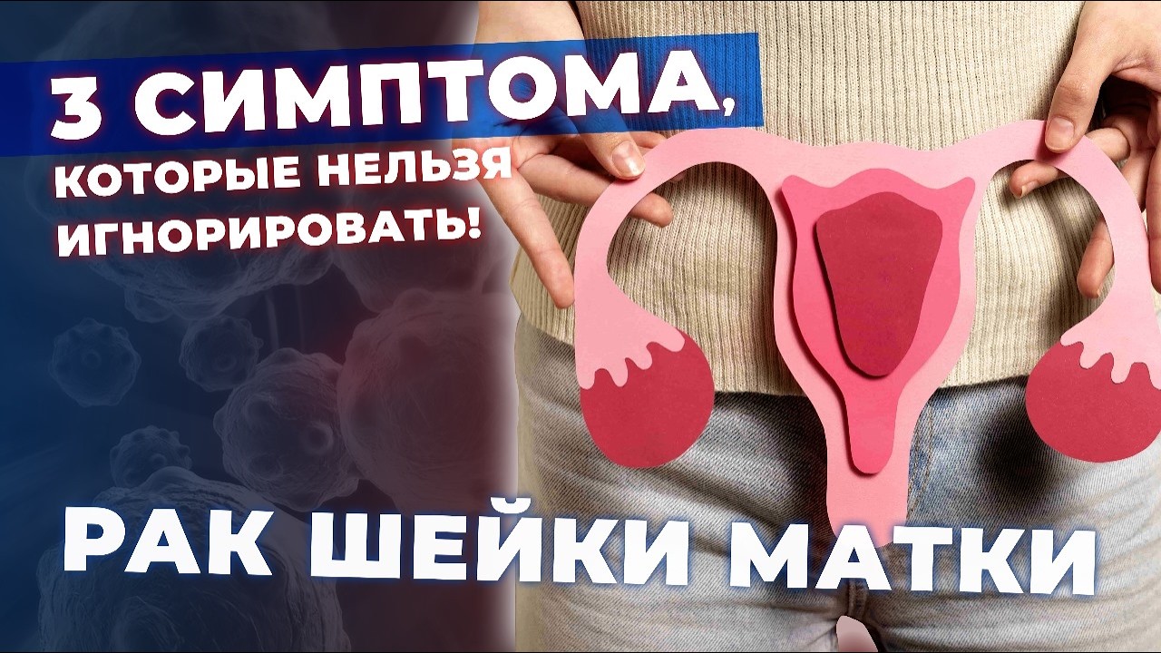Рак шейки матки | ранние симптомы и признаки рака шейки матки