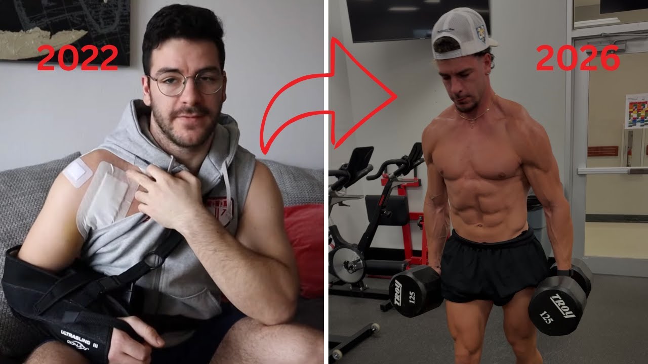 4 Jahre nach Latarjet OP – Schulter Update, Kraft & Training