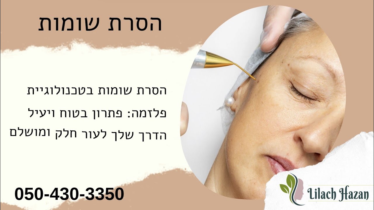 הסרת שומות ללא ניתוח - לילך חזן 050-430-3350