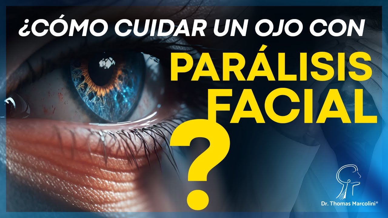 &iexcl;Riesgo de perder la visi&oacute;n despu&eacute;s de una par&aacute;lisis facial! &iexcl;Cuidado!