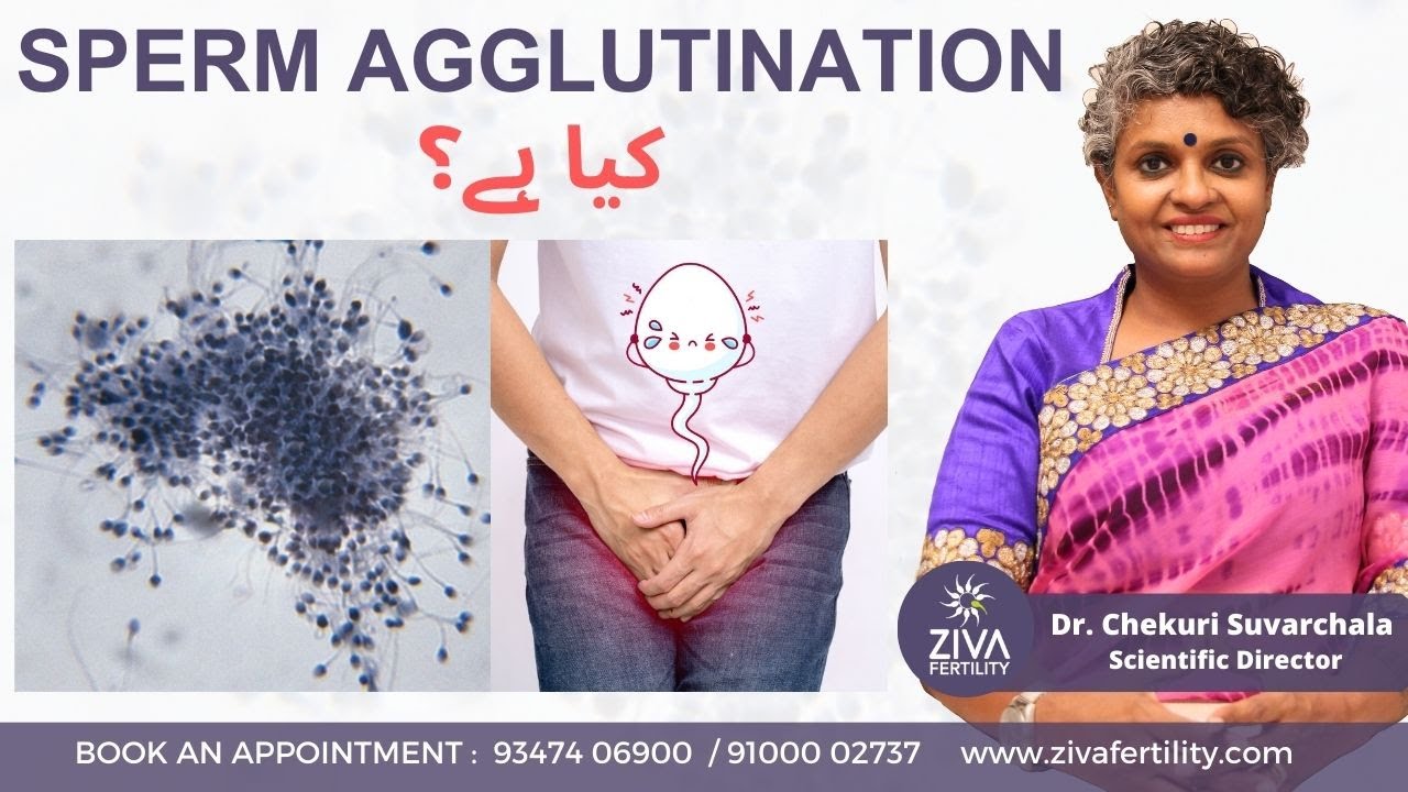 Sperm Agglutination | Dr C Suvarchala | Ziva Fertility Sperm Agglutination کیا ہے؟
