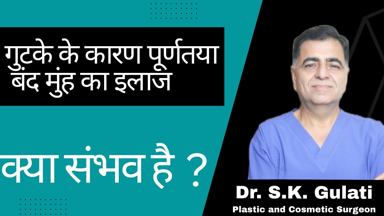 पान मसाला खाने के कारण बंद मुंह की सर्जरी || surgery for Oral submucous fibrosis