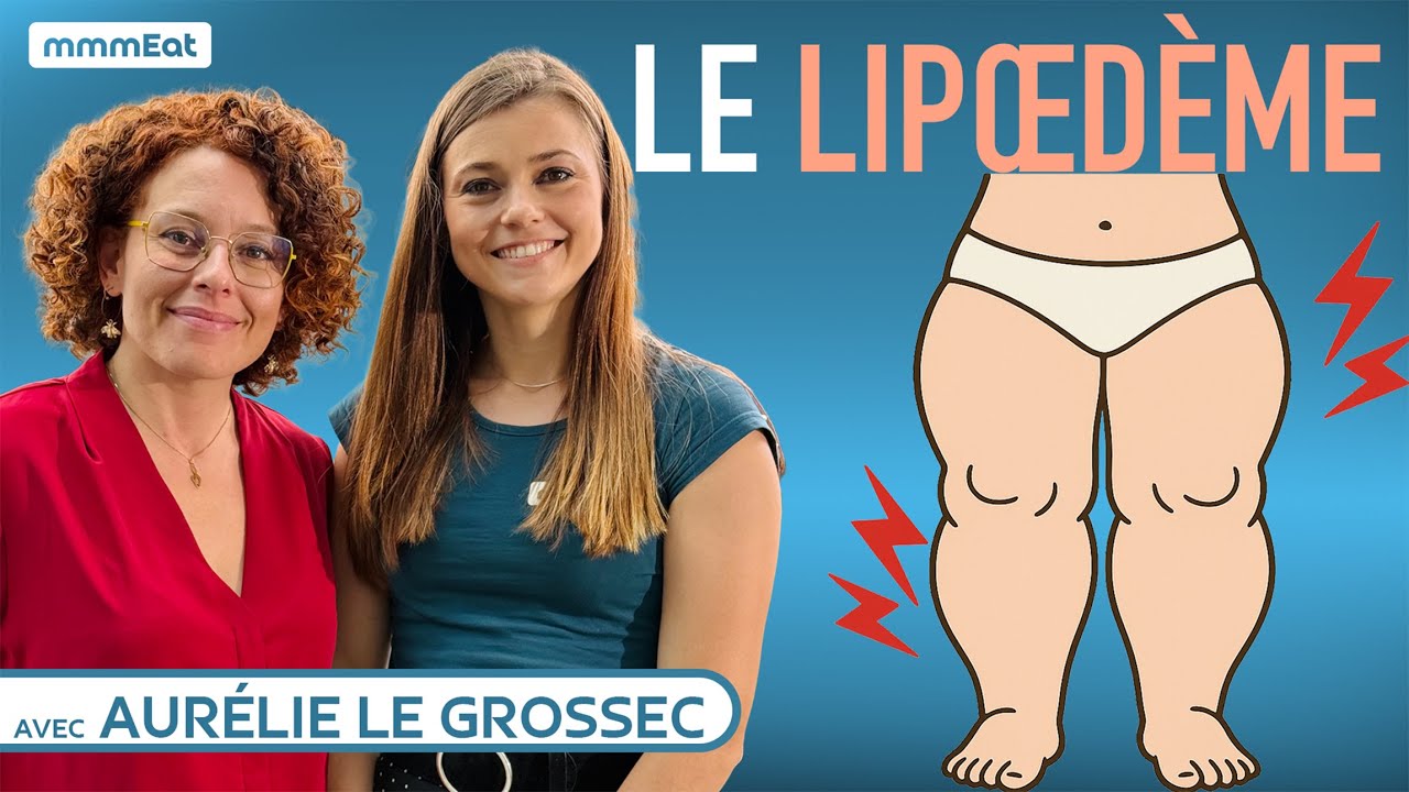 Le lipœdème (la maladie des grosses jambes), avec Aurélie Le Grossec