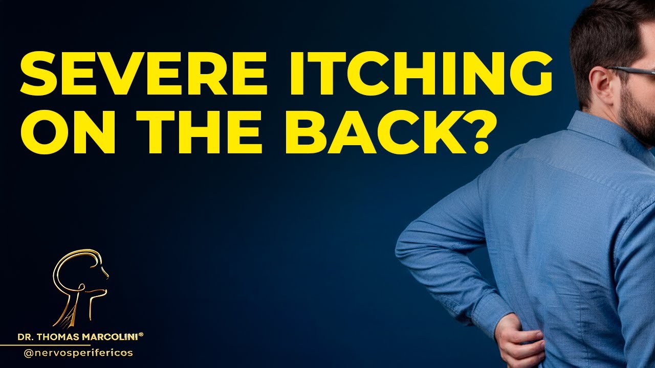 Itchy Back With No Diagnosis – The Hidden Nerve Condition Explained