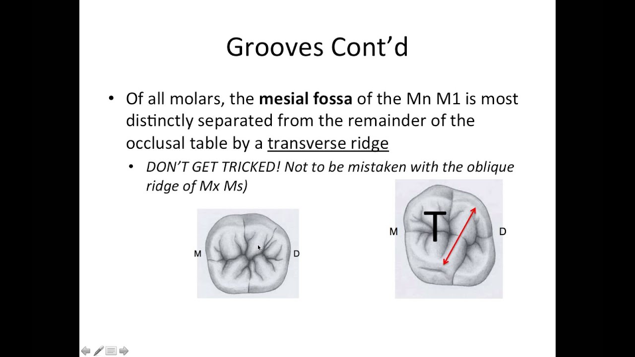 11 Mandibular First Molar - NBDE Part 1 Boards Study