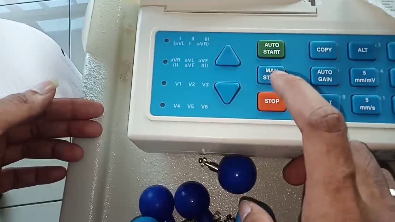 ALAT ECG !! PERBAIKAN PRINTER ECG SCHILLER AT 1 !! No, Setingan