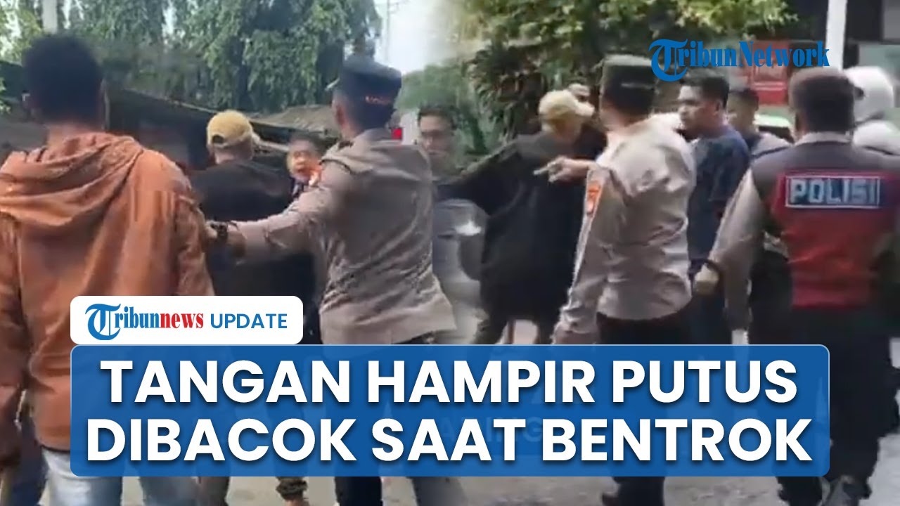 Kondisi Korban Pembacokan saat Bentrokan 2 Ormas di Kelapa Gading: Dahi Terluka, Tangan hampir Putus
