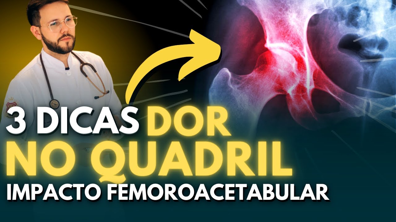 3 MELHORES DICAS PARA TRATAR O IMPACTO FEMOROACETABULAR