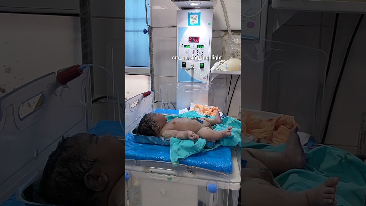 Newborn Baby In Radiant Warmer | Infant Radiant Warmer 