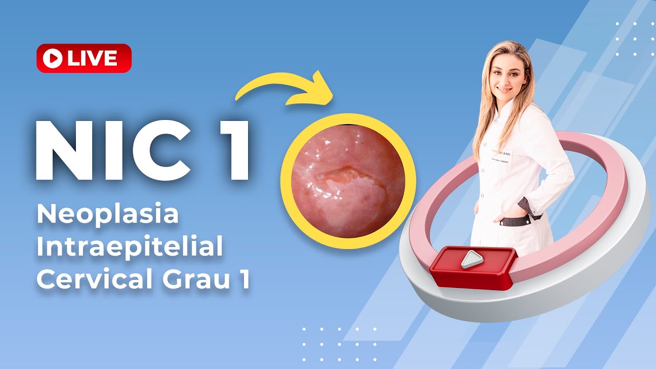 Qual o tratamento de Nic 1?