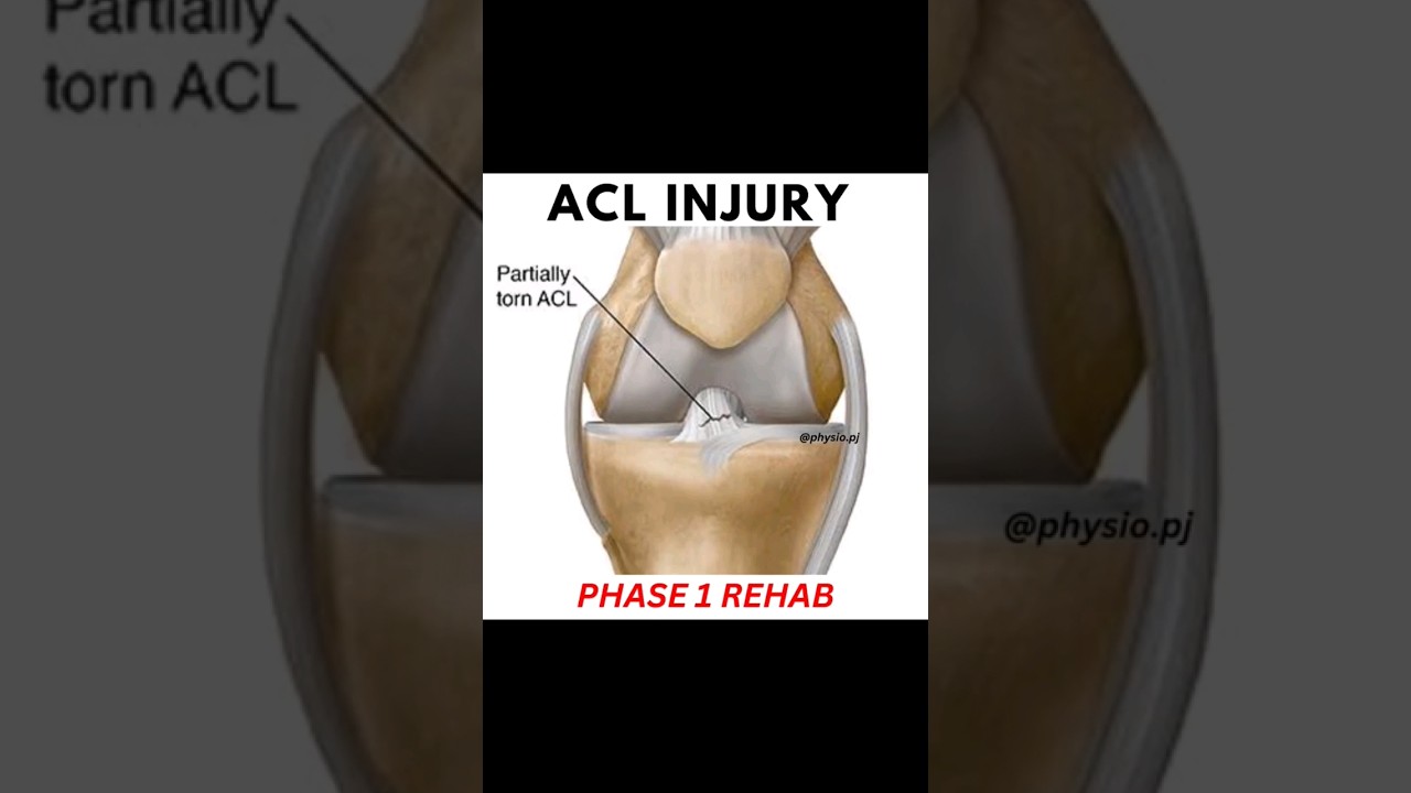 5 Best ACL Recovery Exercises | Phase 1 Rehab