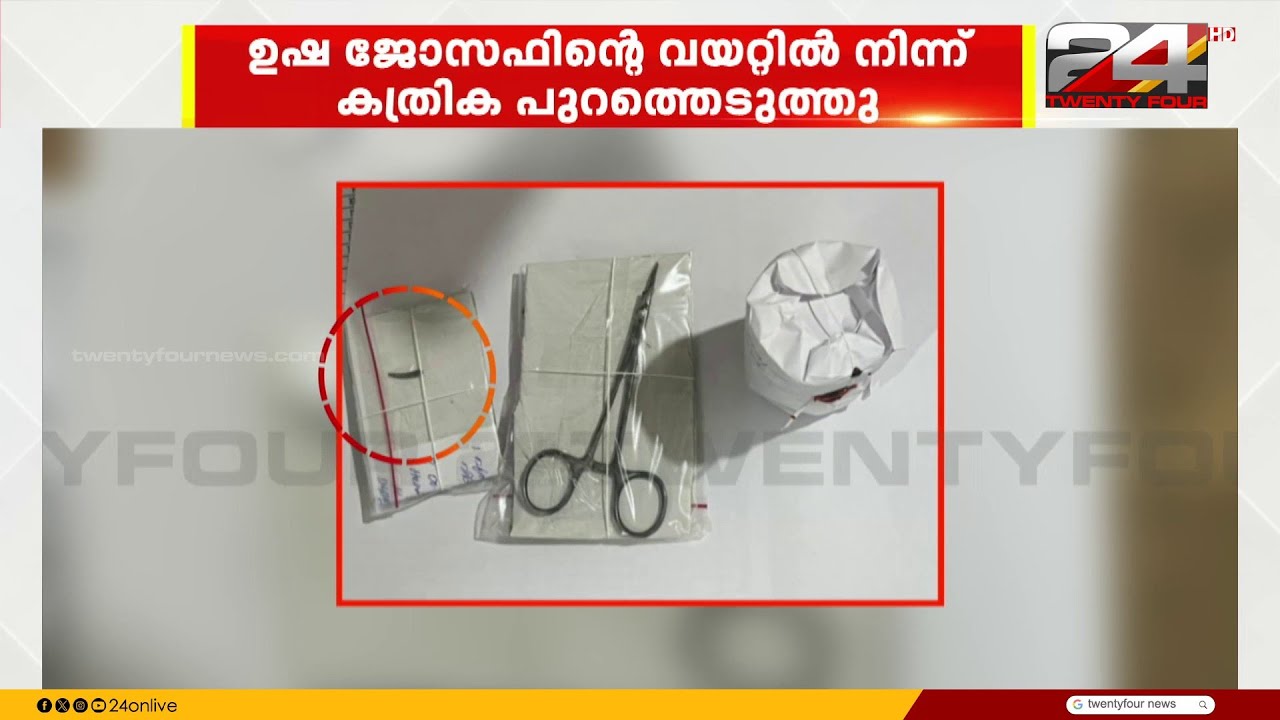 ഉഷ ജോസഫിന്റെ വയറ്റിൽ നിന്ന് കത്രിക പുറത്തെടുത്തു, അഗ്രഭാഗം ഒടിഞ്ഞ നിലയിൽ | Usha Joseph