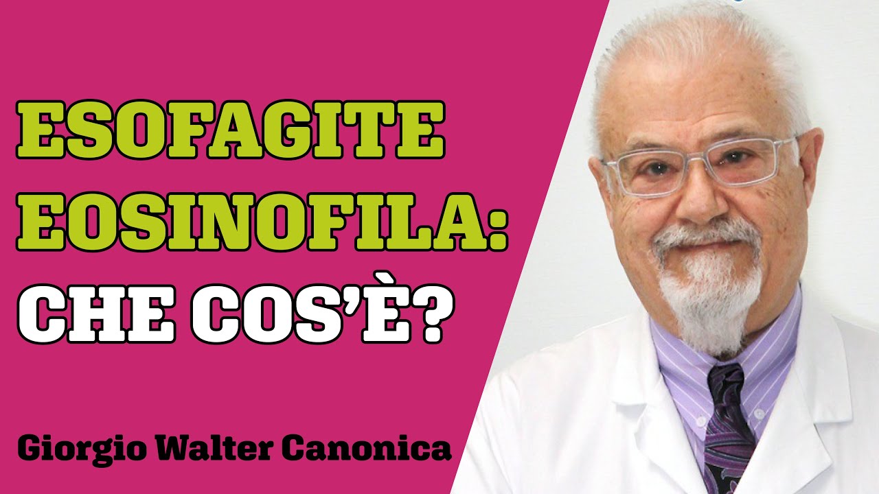 Cosa bisogna sapere sull'esofagite eosinofila