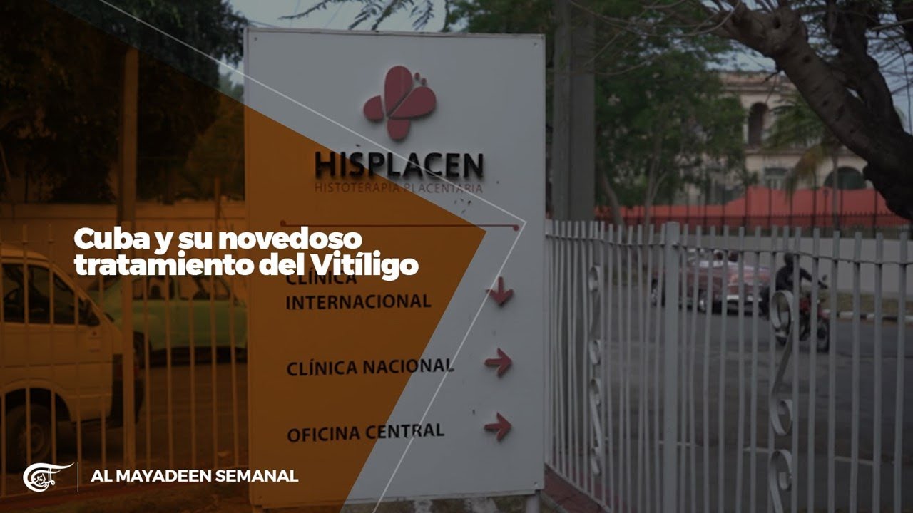 Cuba y su novedoso tratamiento del Vitíligo