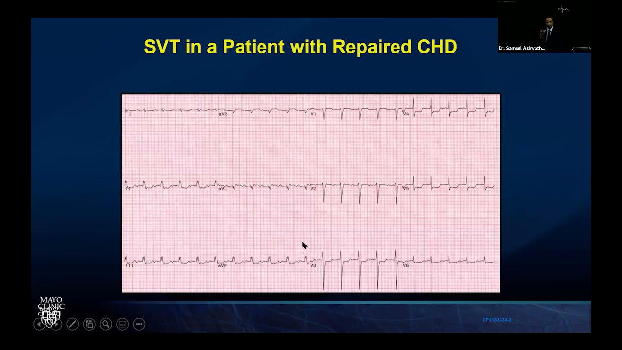 Heart Rhythm Webinar Series