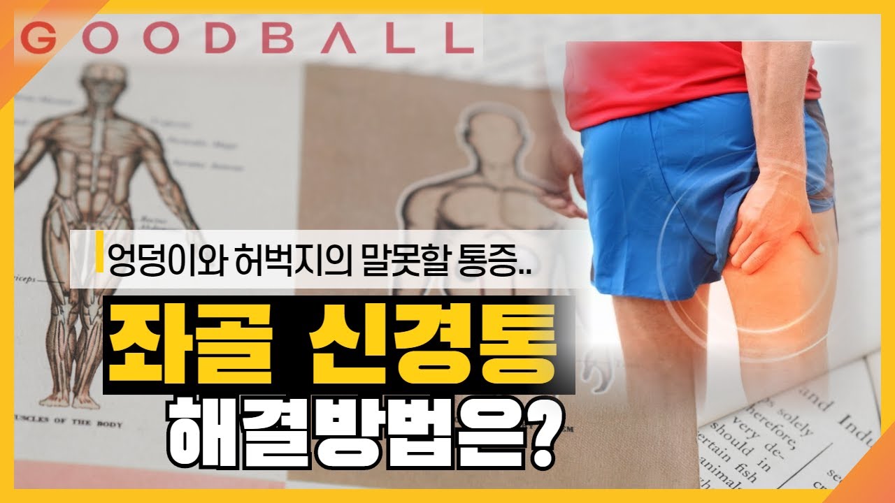 말 못 할 엉덩이, 허벅지 통증 증상, 좌골신경통 개선 방법! (이상근증후군, Sciatic neuralgia, Sciatica, piriformis syndrome)