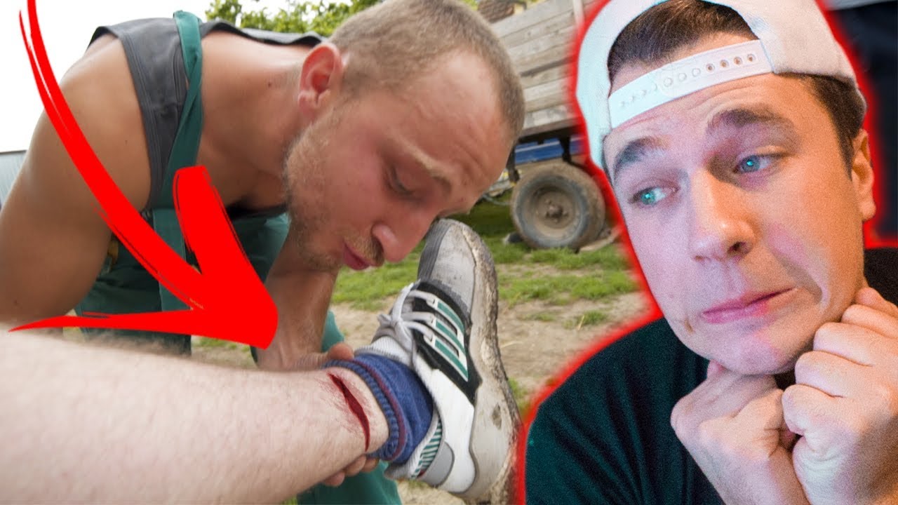 SKORO SAM IZGUBIO NOGU! *SNIMLJENO*