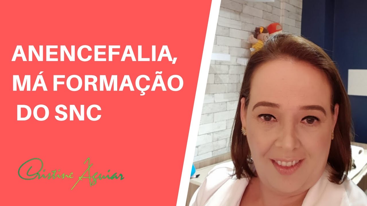 Anencefalia, má formação do SNC
