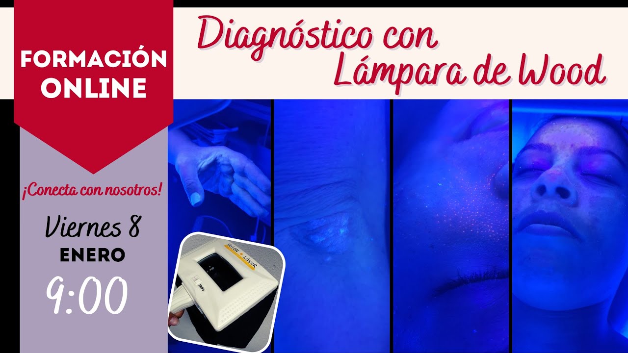 ¿Cómo usamos una Lámpara de Wood?