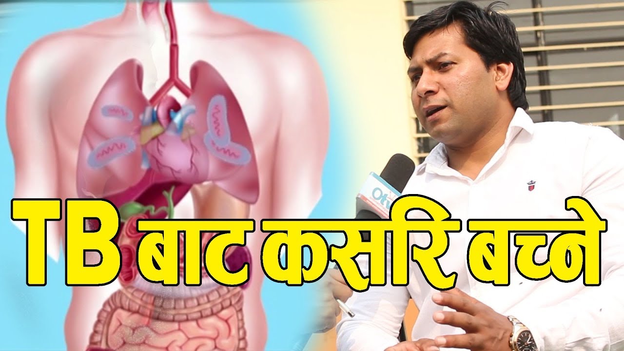 स्वास्थ्य सरोकार : TB रोग कसरि लाग्छ ! यसका लक्षण के- के हुन् ? र यसबाट कसरि बच्ने - Dr. Sudhir Shah