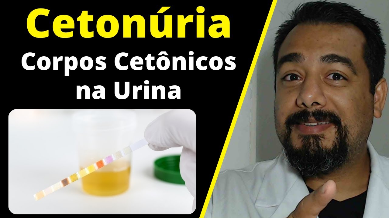 Presença De Corpos Cetônicos Na Urina (Cetonúria): O Que São, Por Que Aparecem No Exame De Urina?