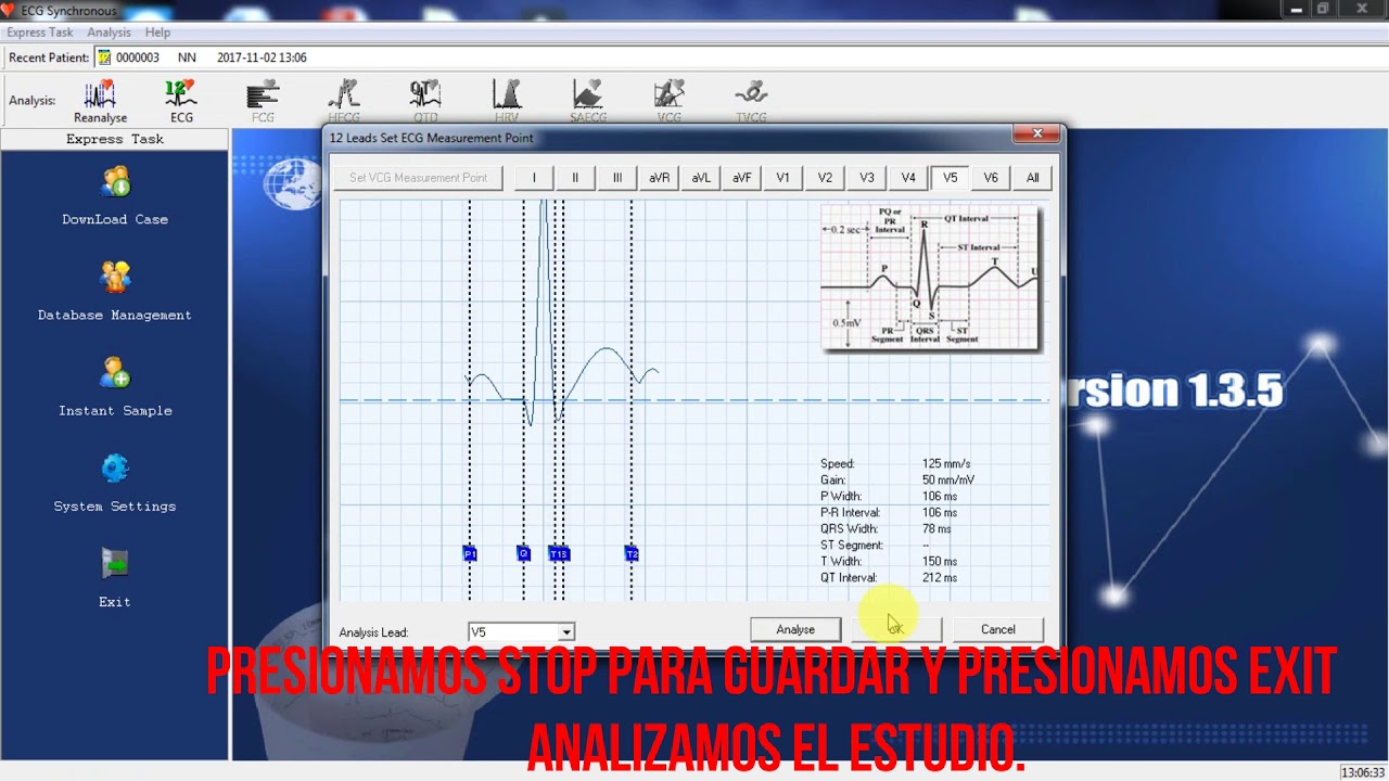 ECG CONTEC USO DE PROGRAMA