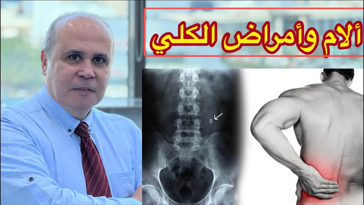 علامات امراض الكلي👈 وصديد في البول ودم 👈اكثر الامراض انتشارا في الكلي👈التحاليل والاشعات المطلوبه