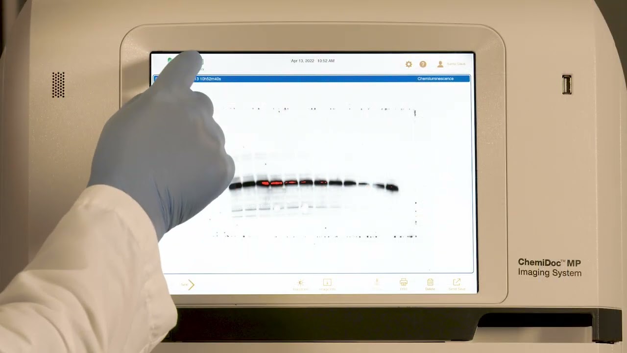 Quick Tips: Signal Accumulation Mode on a ChemiDoc Imaging System for Western Blotting