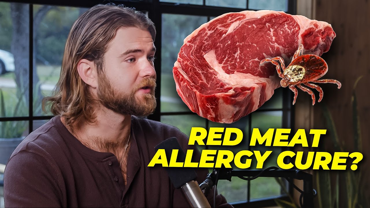 Alpha Gal Syndrome: A Deep Dive into the Red Meat Allergy Epidemic