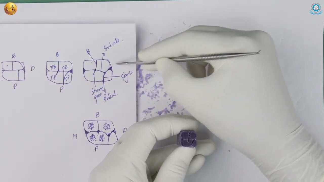 How to Perfectly Carve the Maxillary First (1st) Molar Step-by-step II MGMDCH