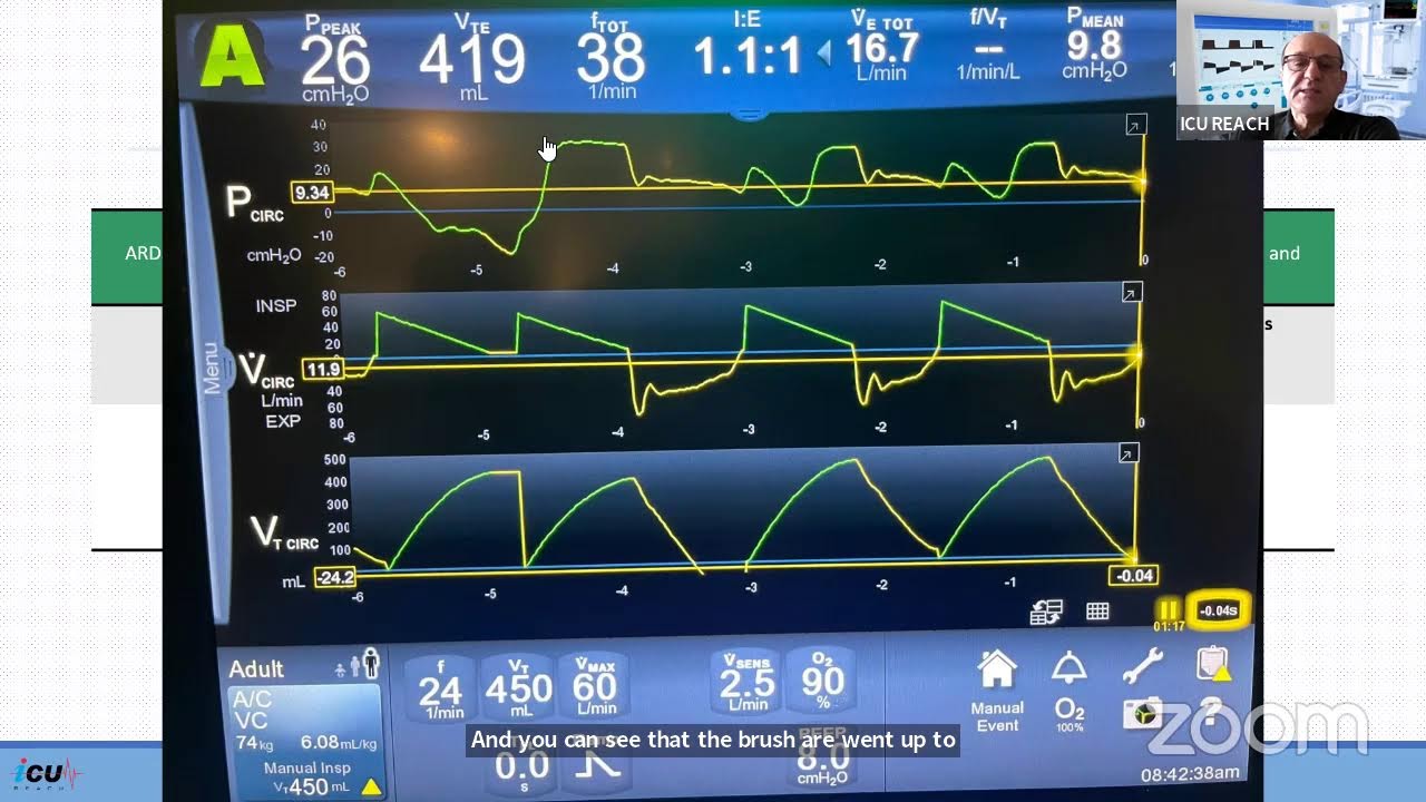 Mechanical Ventilation Case Studies