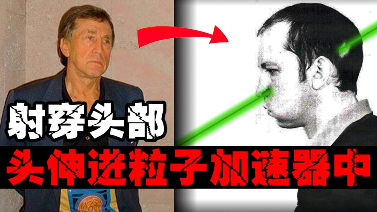 【粒子束爆头事故】射穿大脑400倍致死辐射后，奇迹般的活了下来【郑郑得证】