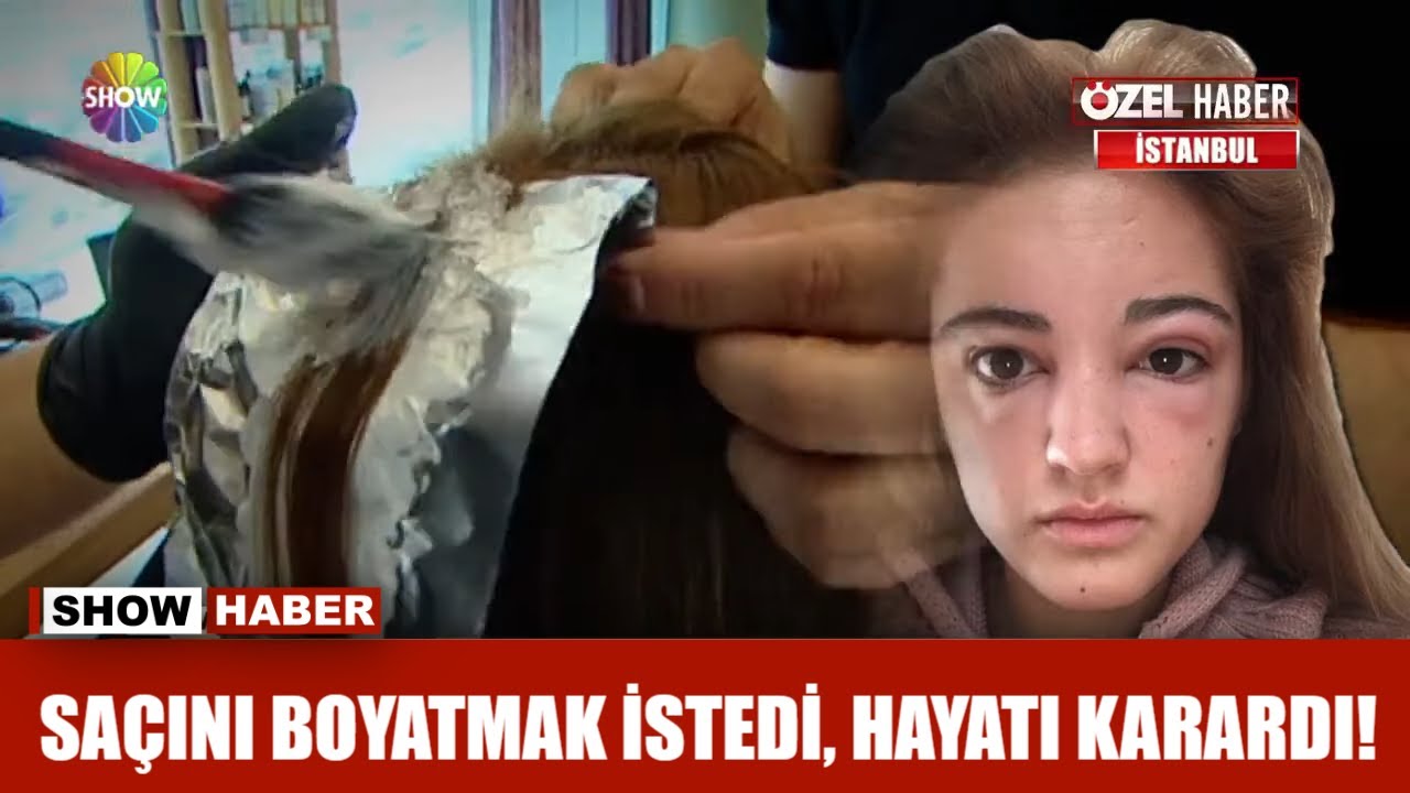 Saçını boyatmak istedi, hayatı karardı!