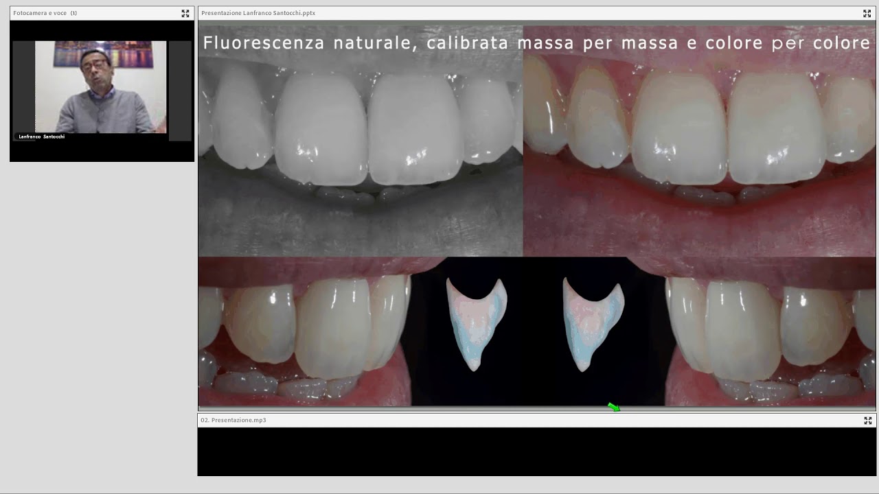 Duceram Kiss - la tecnica incontra la creatività