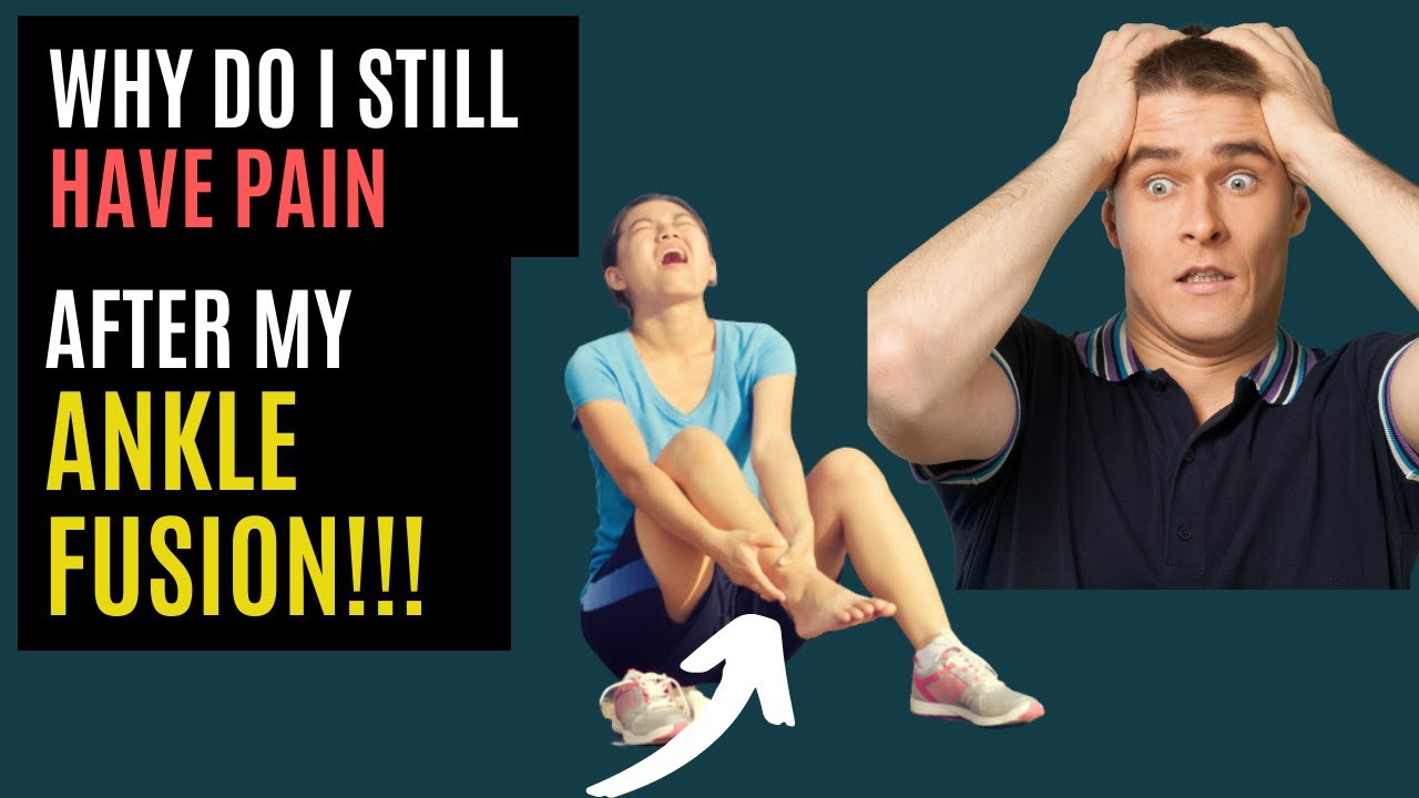 Why Do I Still Have Pain After My Ankle Fusion!!!