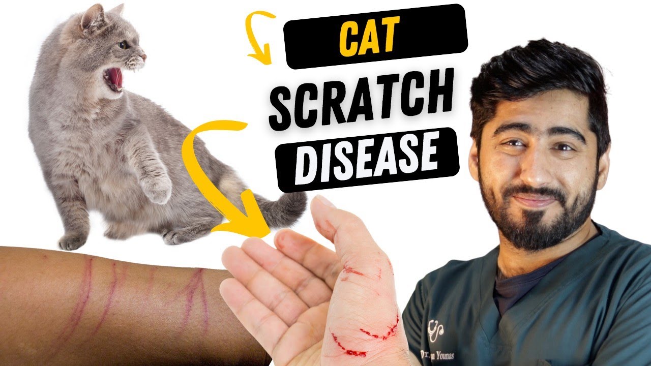 Cat Scratch fever || Bite wound treatment || Causes, Symptoms & Treatment || Animalia Dot Pk