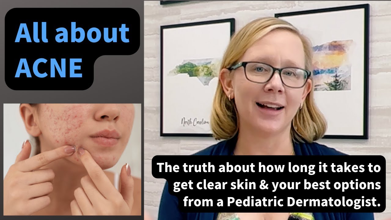 Pediatric Dermatologist talks options for acne treatment and what to expect at a visit