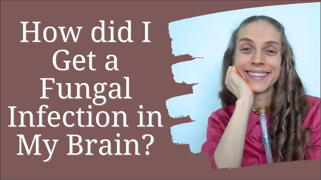 How Did I Get a Fungal Infection in My Brain & What is Candida Parapsilosis. Life with a Vent