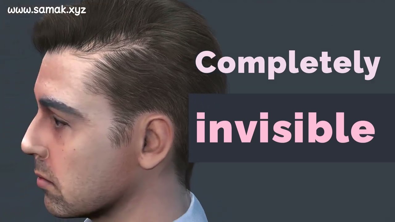 Unitron Insera CIC &mdash; Invisible Hearing Technology from Canada