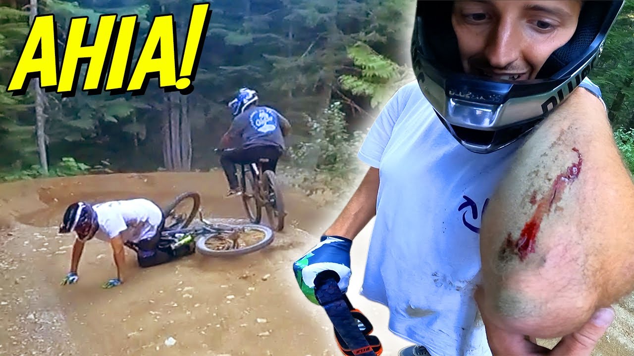 COME APRIRSI UN BRACCIO IN MTB con 
