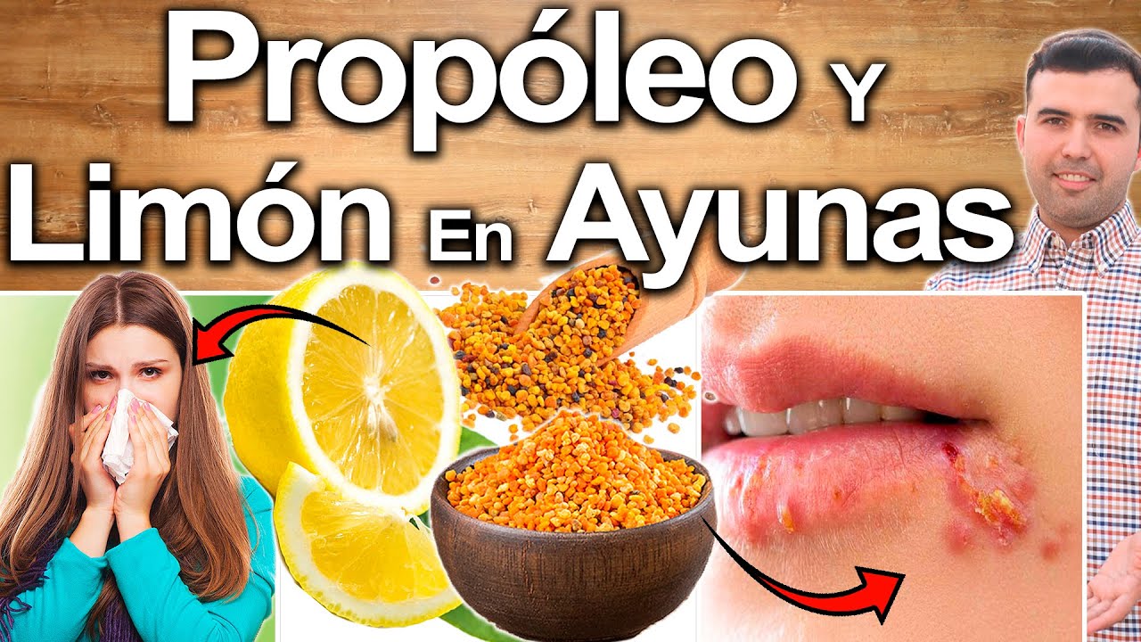 Prop&oacute;leo Y Lim&oacute;n Para Todo! - Para Qu&eacute; Sirve El Propoleo? - Beneficios Para Tu Salud Y Belleza
