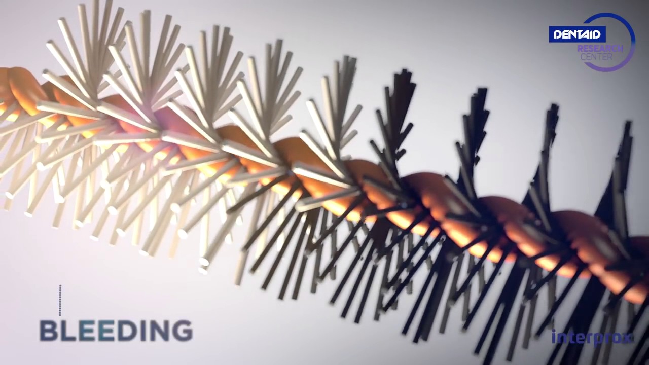 The interproximal cleaning revolution has arrived  New Interprox&reg;