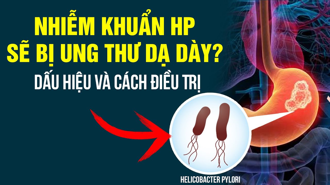 Nhiễm H.P Là Sẽ Bị Ung Thư Dạ Dày Như Đồn Đại? Dấu Hiệu Và Cách Điều Trị |ThS.BS.CK2 Trần Kinh Thành