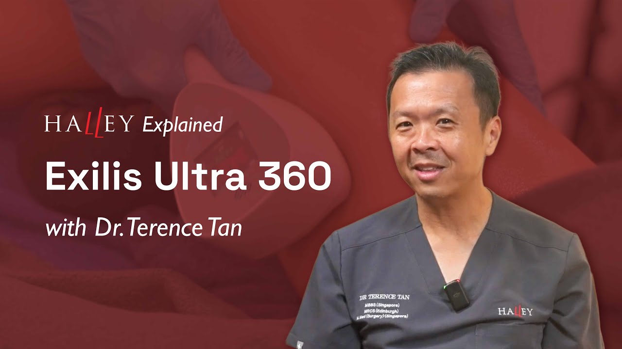 HALLEY EXPLAINED | Exilis Ultra 360