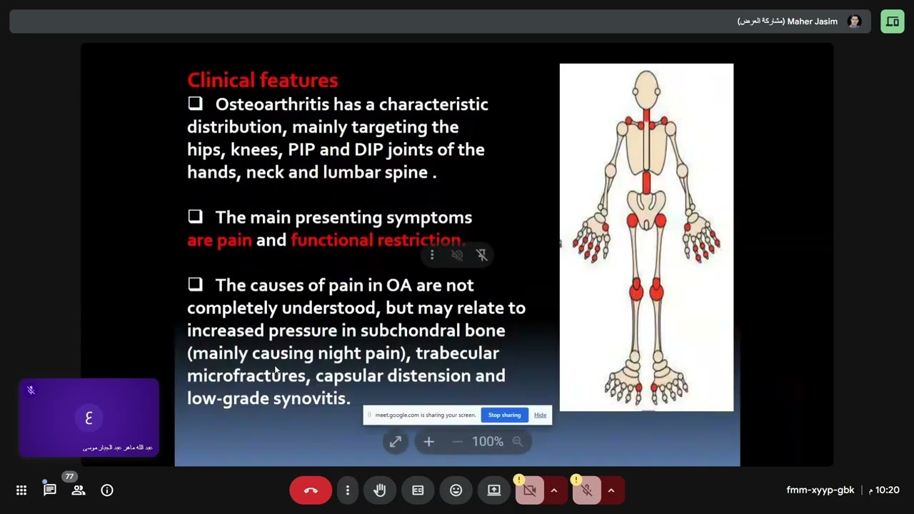 باطنية دكتور ماهر OSTEOARTHRITIS ( OA )
